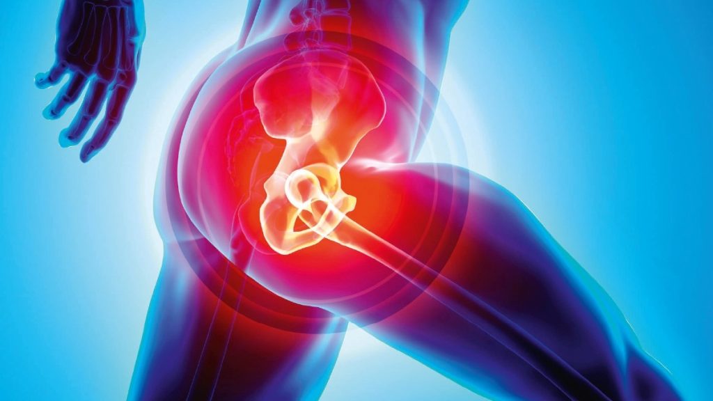 Hip-Replacement-Surgery-in Ambala